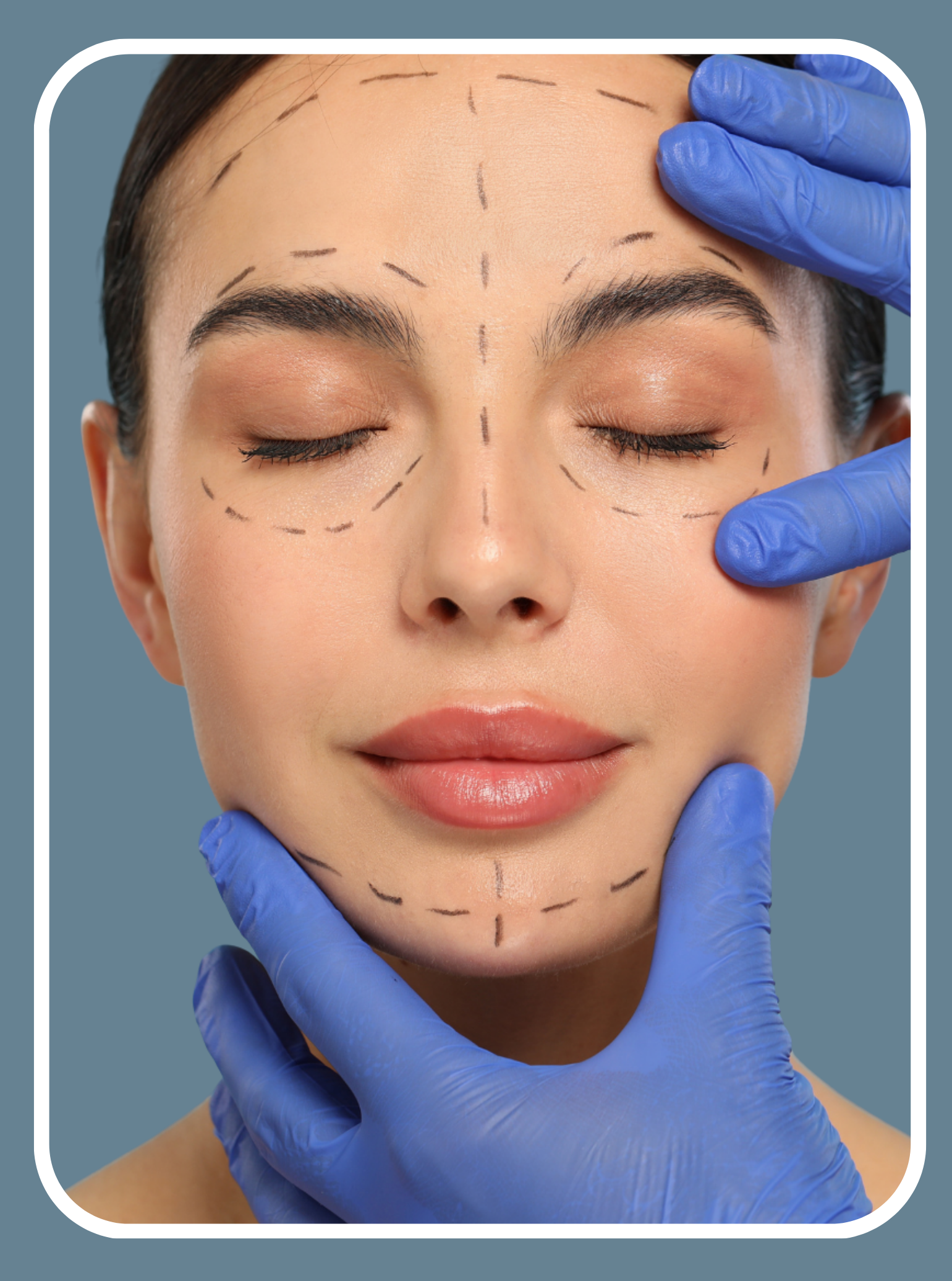 Facial Contouring
