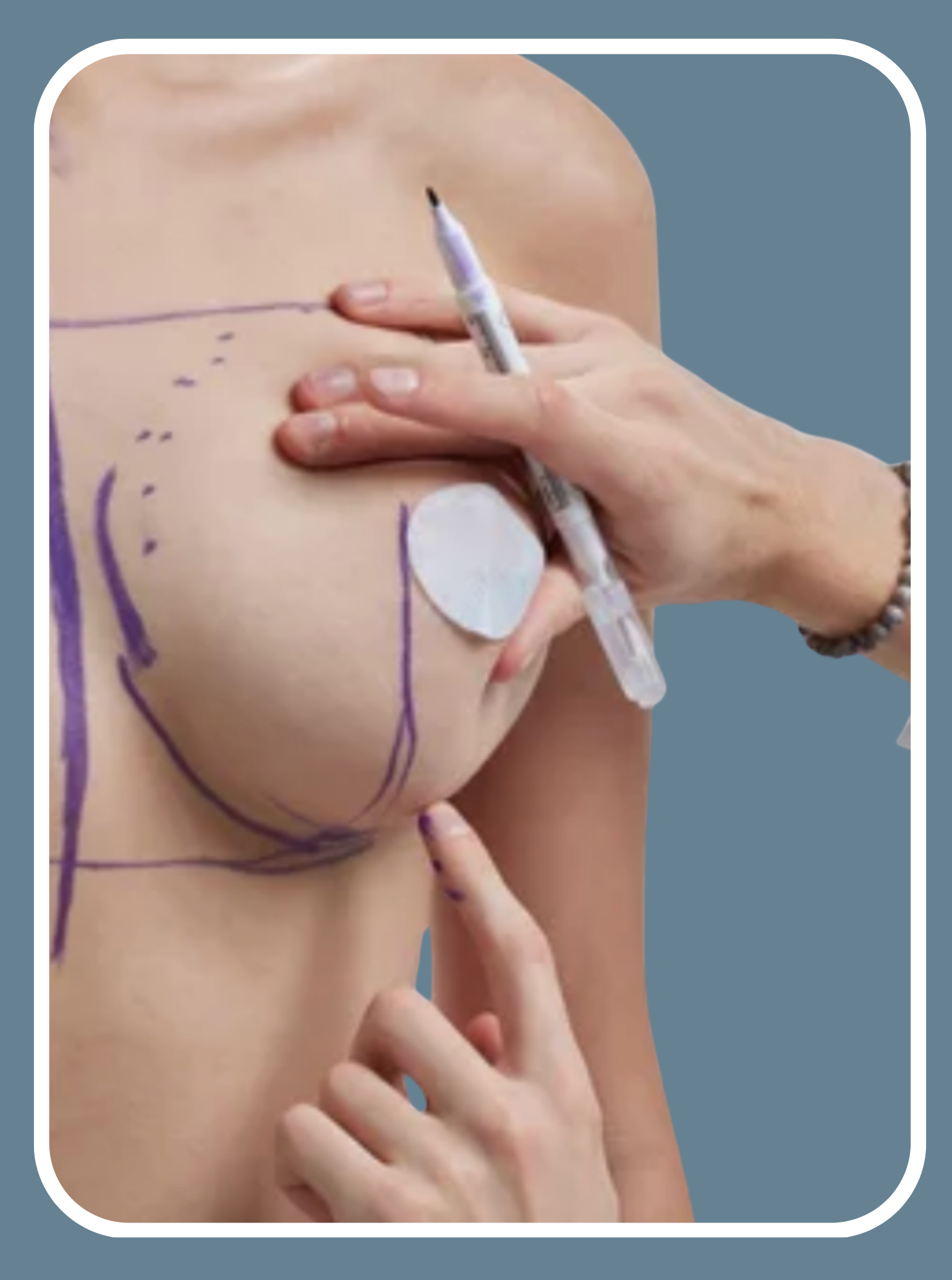 Breast & Chest 